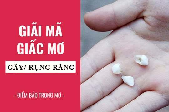 Mơ thấy gãy răng đánh số gì? Giải mã điềm báo lành hay dữ?